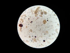 Photo of clay soil under a microscope.